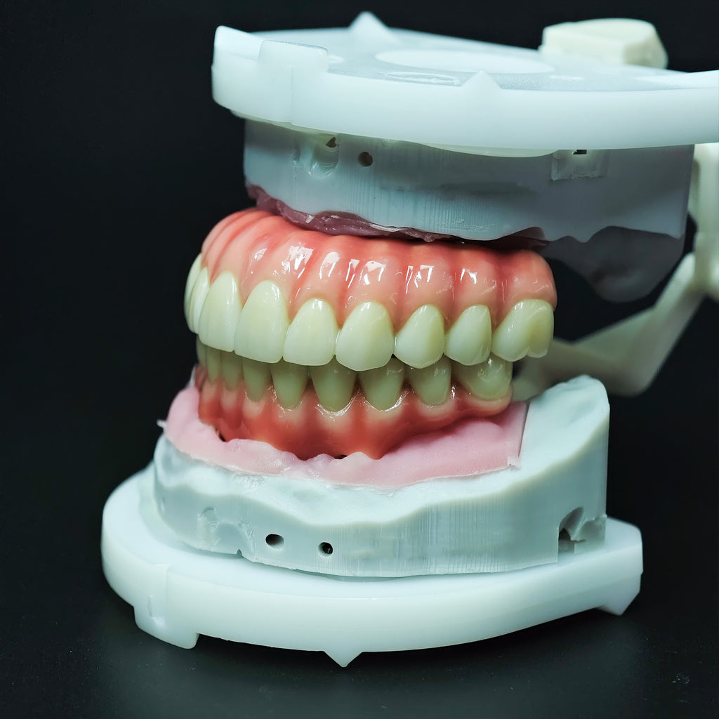 Zirconia-Enamel Hybrid Malo Bridge