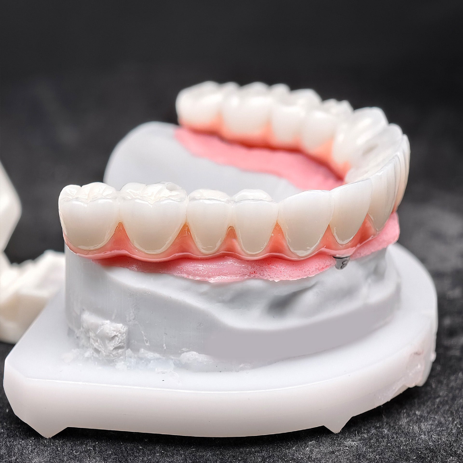 Zirconia-Enamel Hybrid Malo Bridge