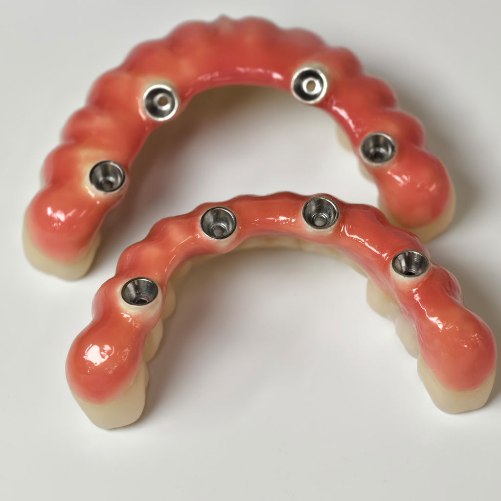 Zirconia-Enamel Hybrid Malo Bridge