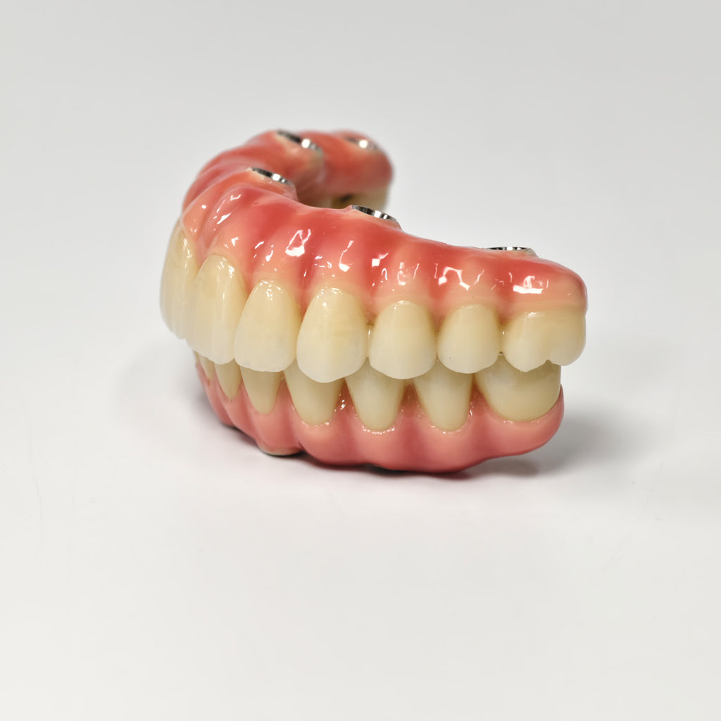 Zirconia-Enamel Hybrid Malo Bridge