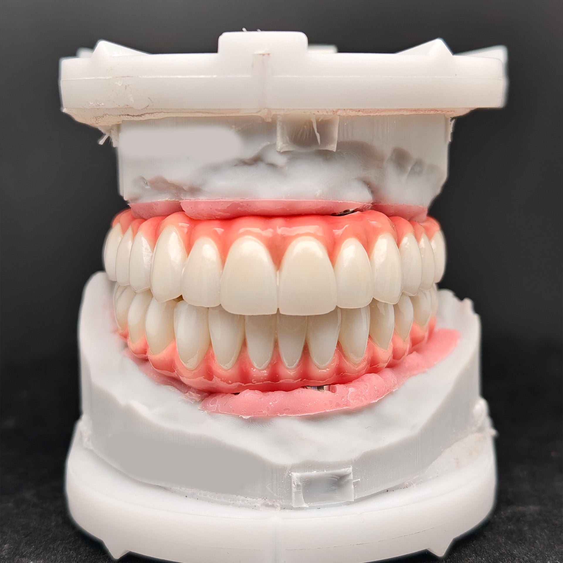 Zirconia-Enamel Hybrid Malo Bridge