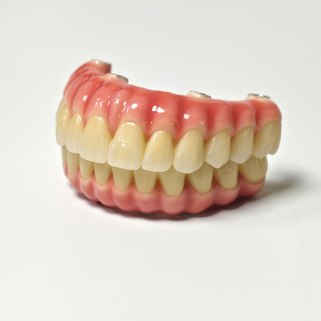Zirconia-Enamel Hybrid Malo Bridge