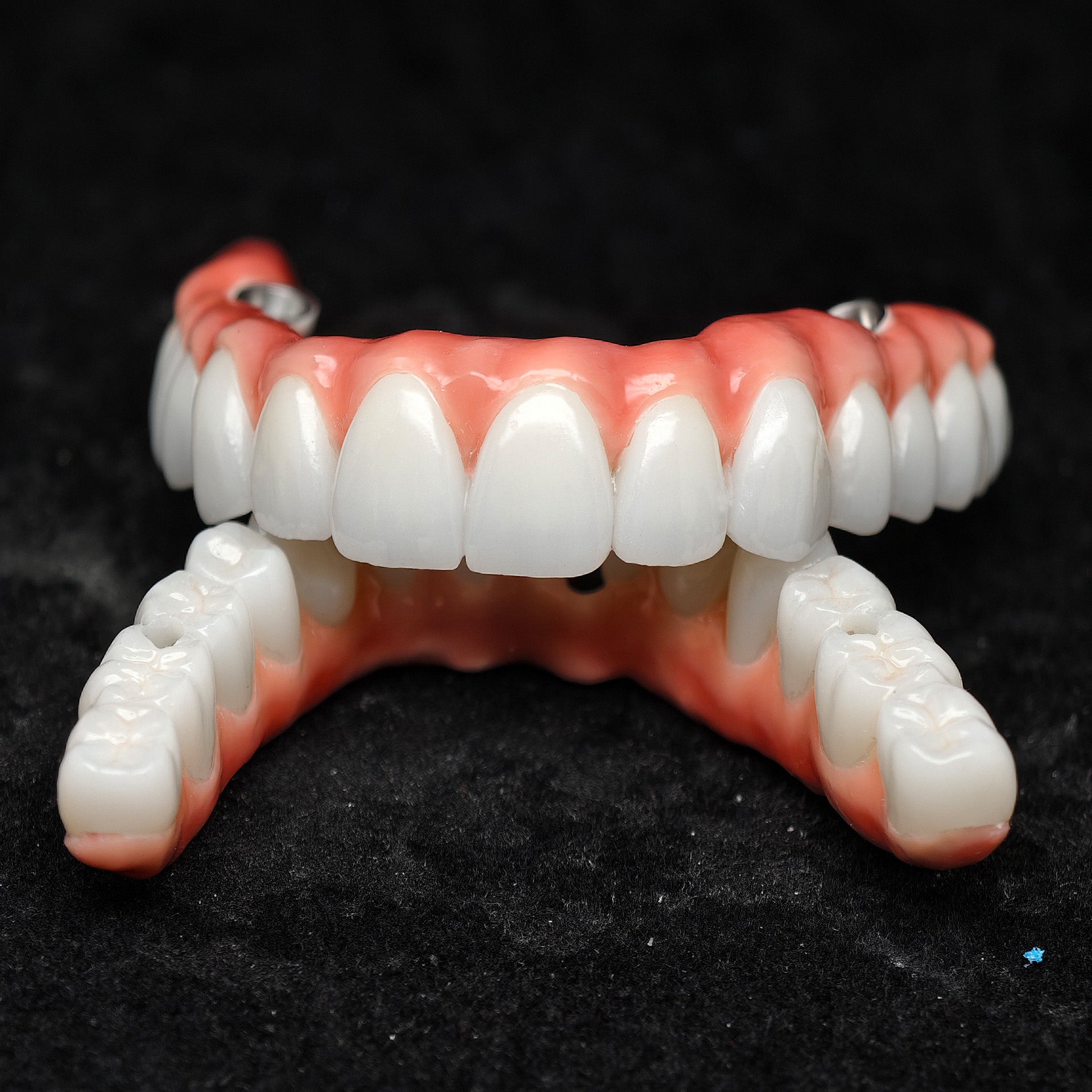 Zirconia-Enamel Hybrid Malo Bridge