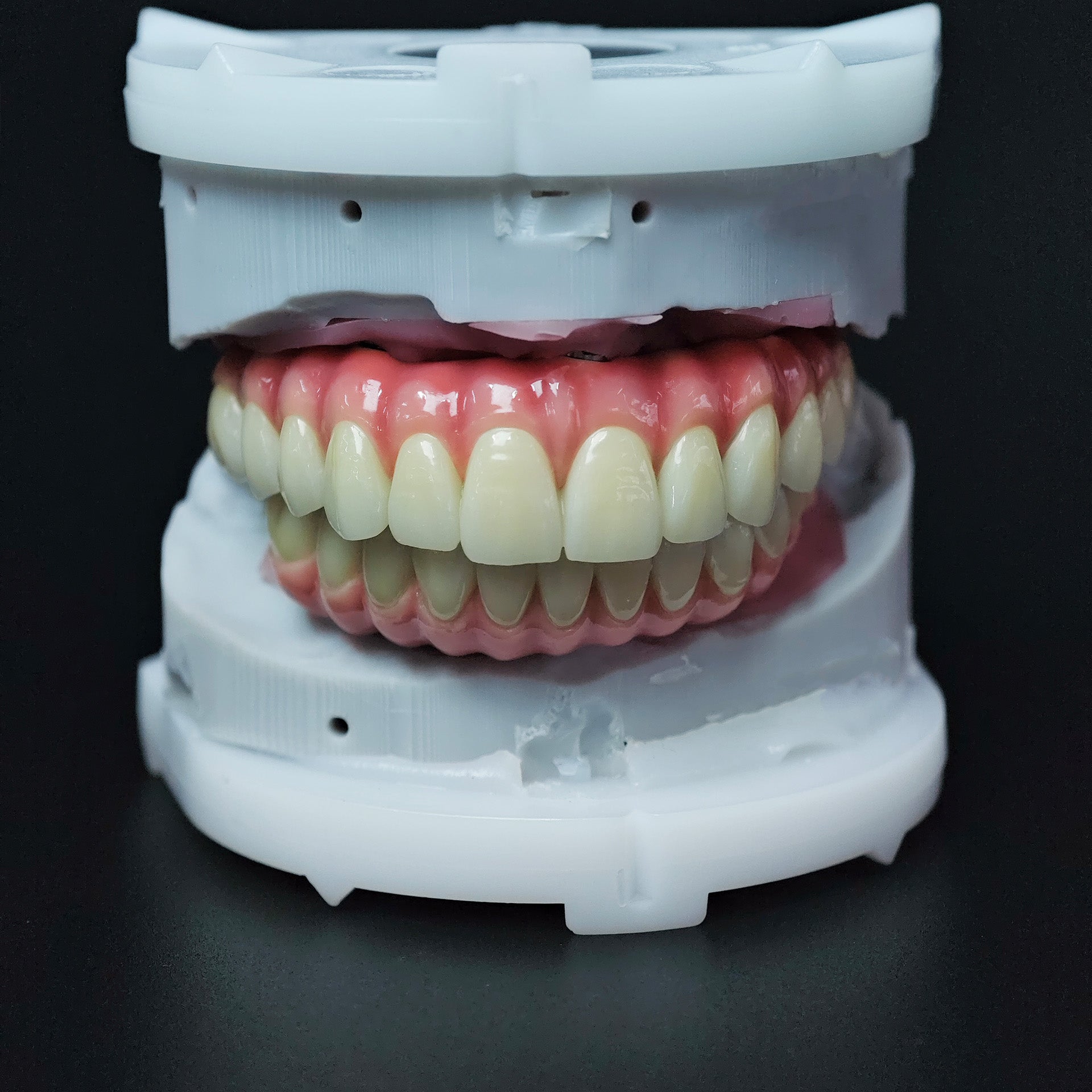 Zirconia-Enamel Hybrid Malo Bridge