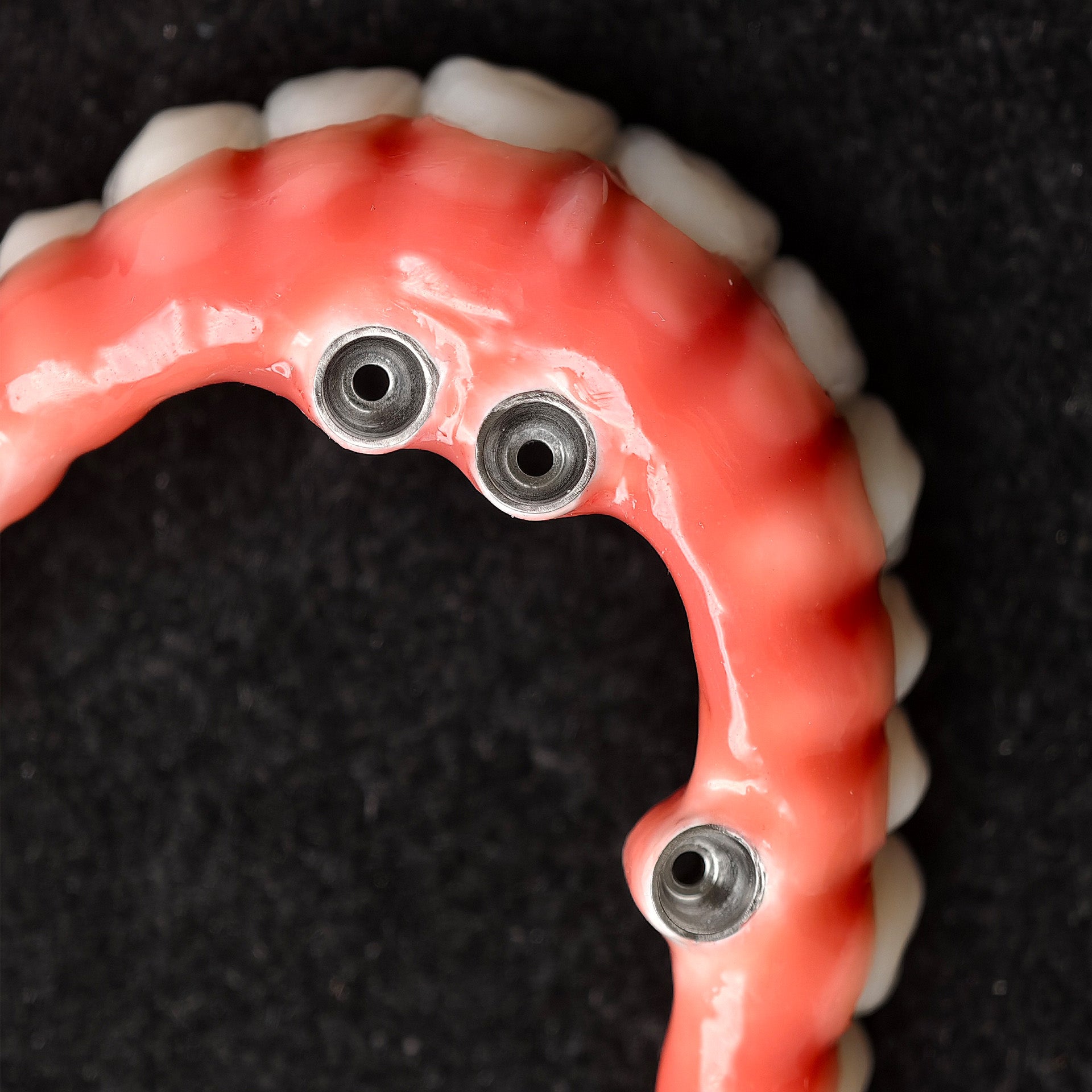 Zirconia-Enamel Hybrid Malo Bridge