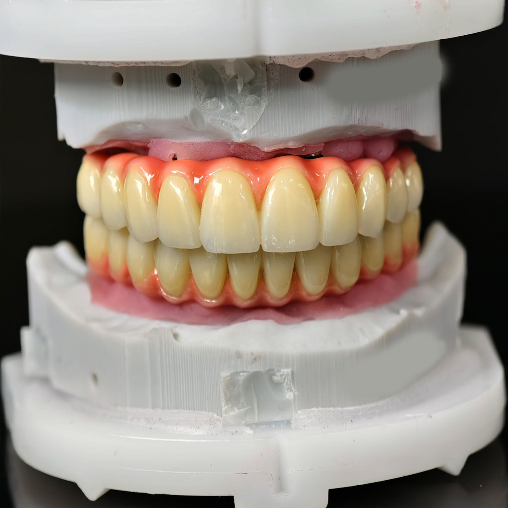 Zirconia-Enamel Hybrid Malo Bridge