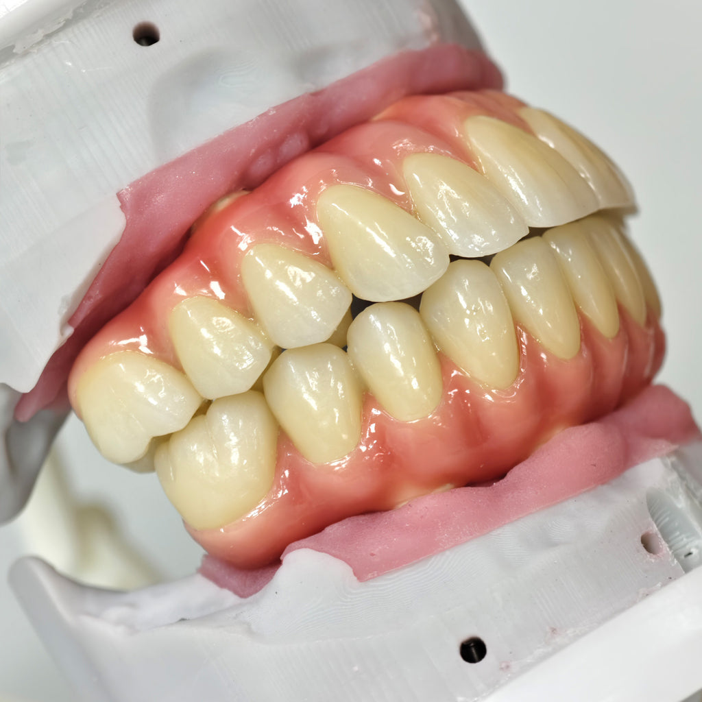 Zirconia-Enamel Hybrid Malo Bridge
