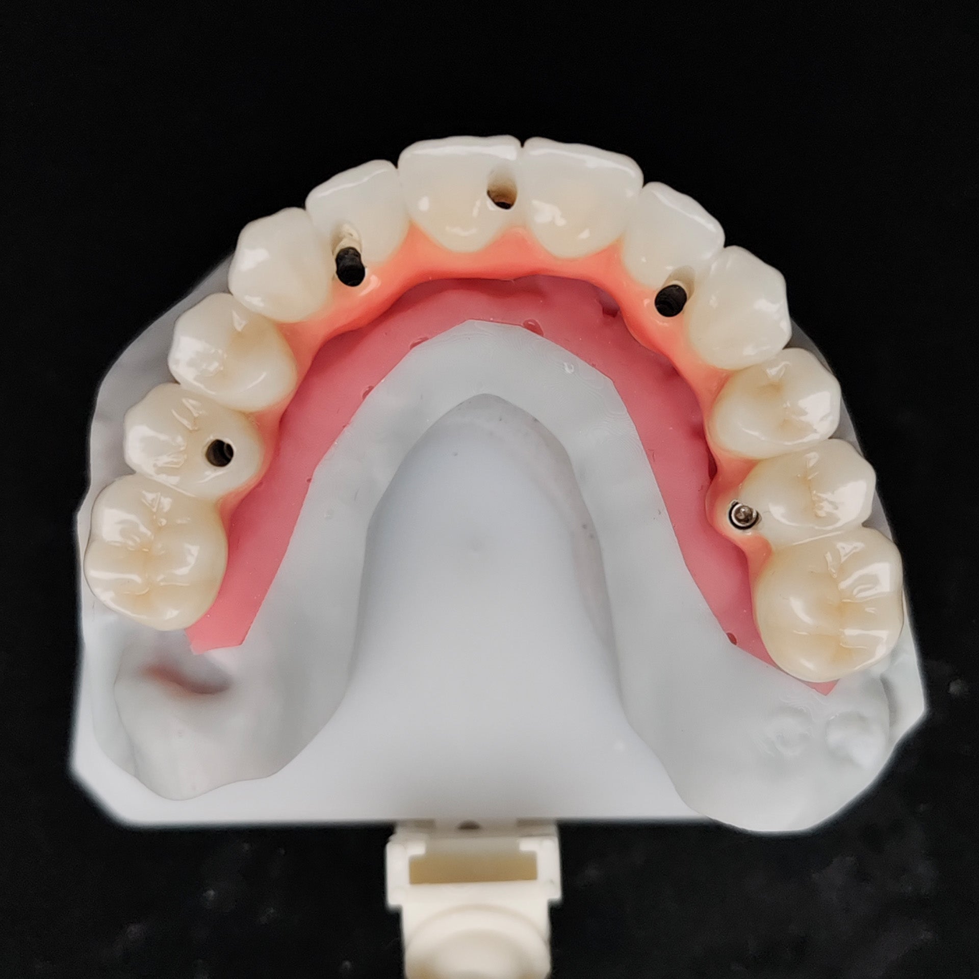 Zirconia-Enamel Hybrid Malo Bridge