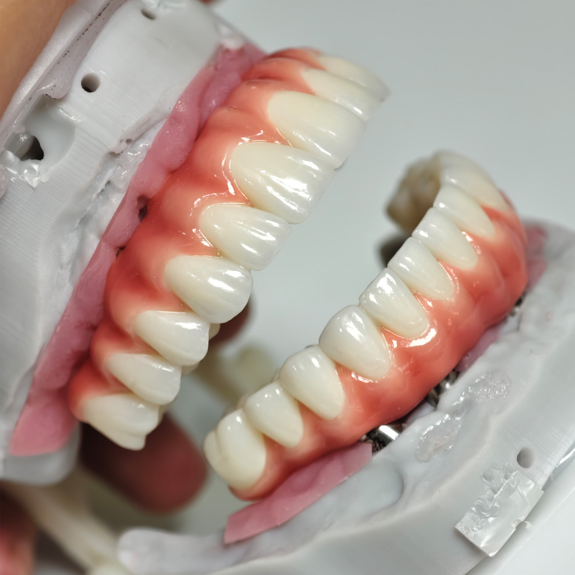 Zirconia-Enamel Hybrid Malo Bridge