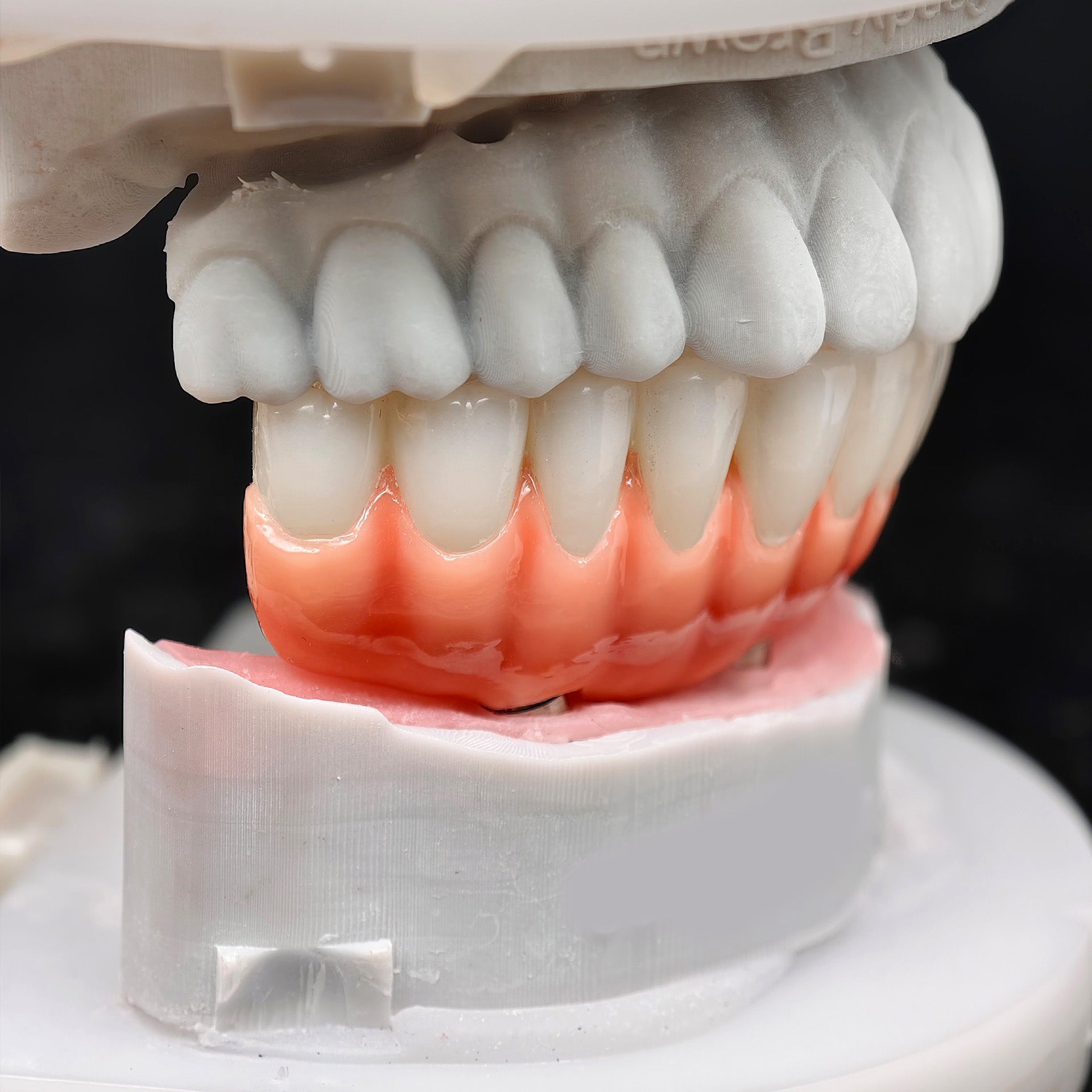 Zirconia-Enamel Hybrid Malo Bridge