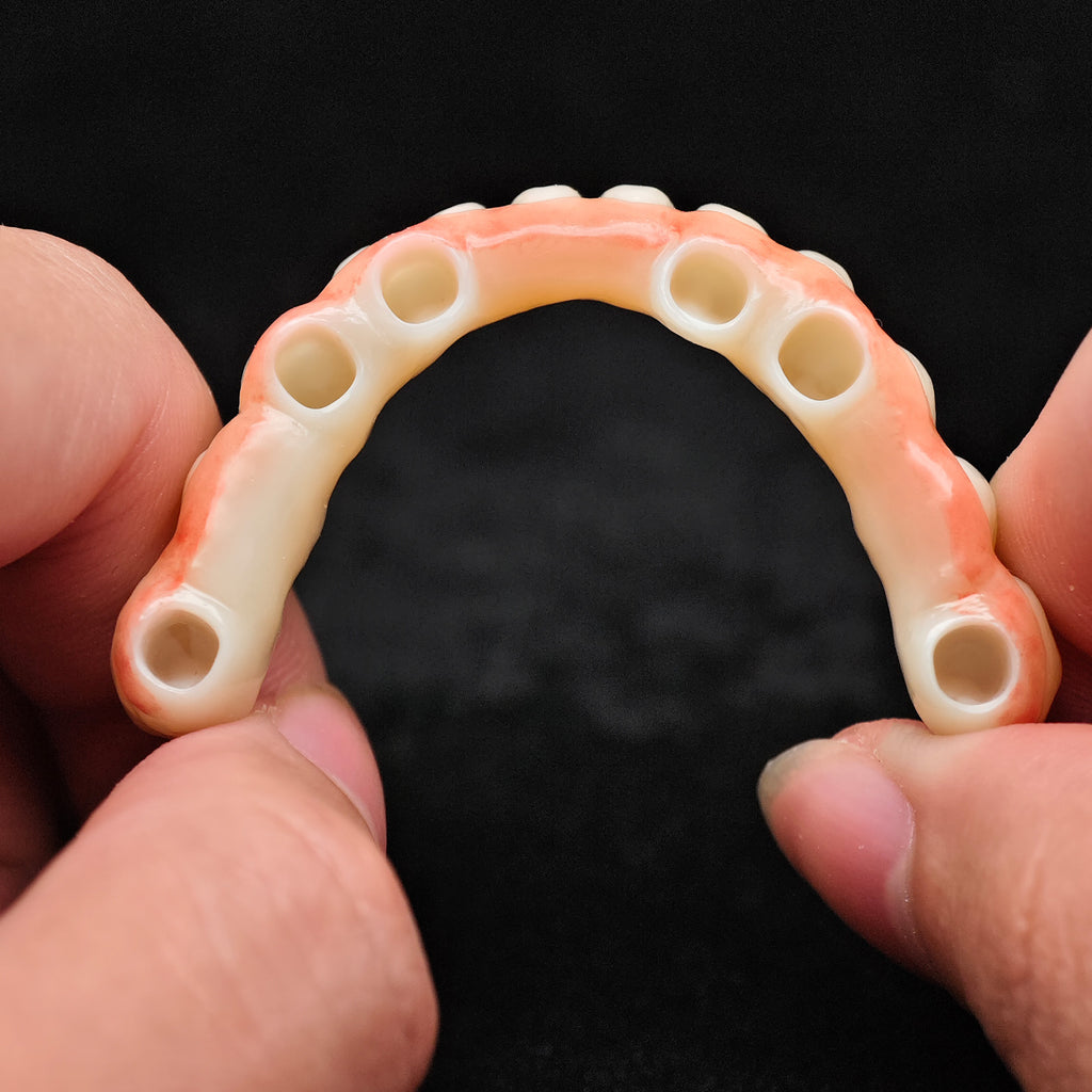 Zirconia Bridge With Cement Retained