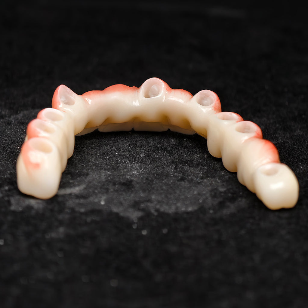 Zirconia Bridge With Cement Retained