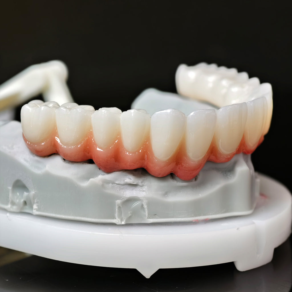 Zirconia Bridge With Cement Retained And Titanium Bar
