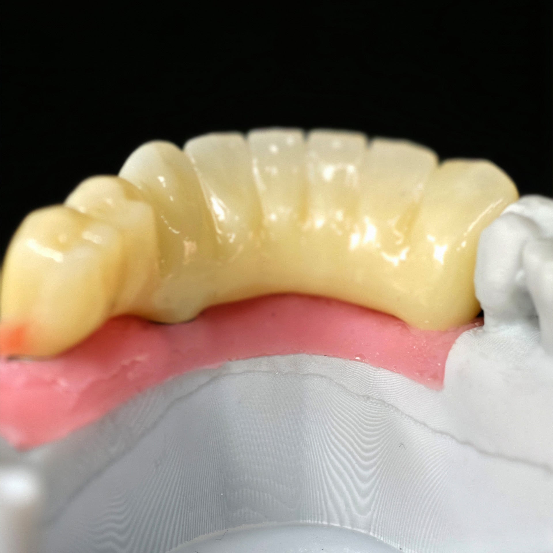 Zirconia Implant Bridge Screwmentable Dental Crown