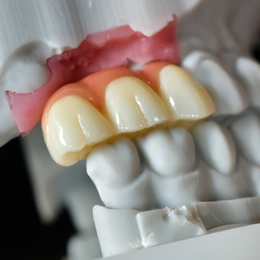 Zirconia Implant Crown Screwmentable Dental Crown