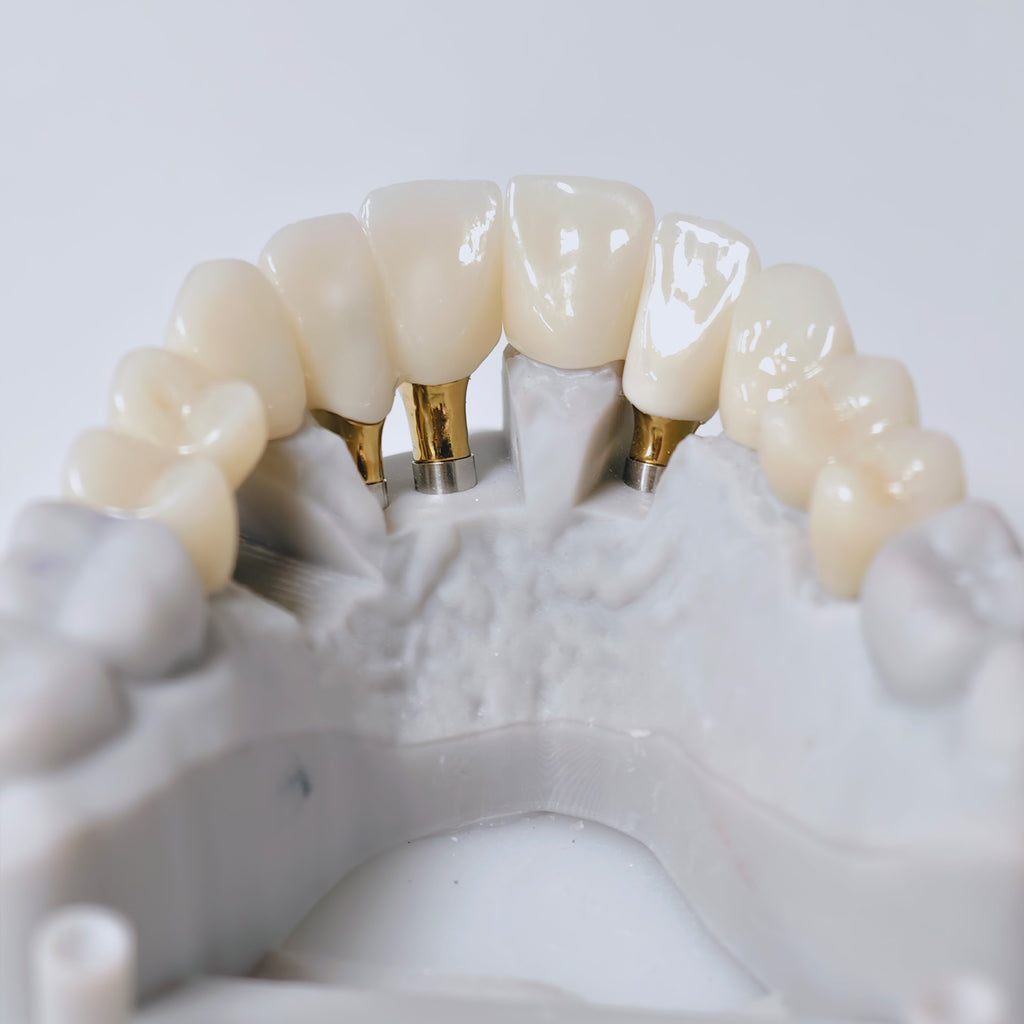 Zirconia Implant Crown And Bridge Screwmentable Dental Crown