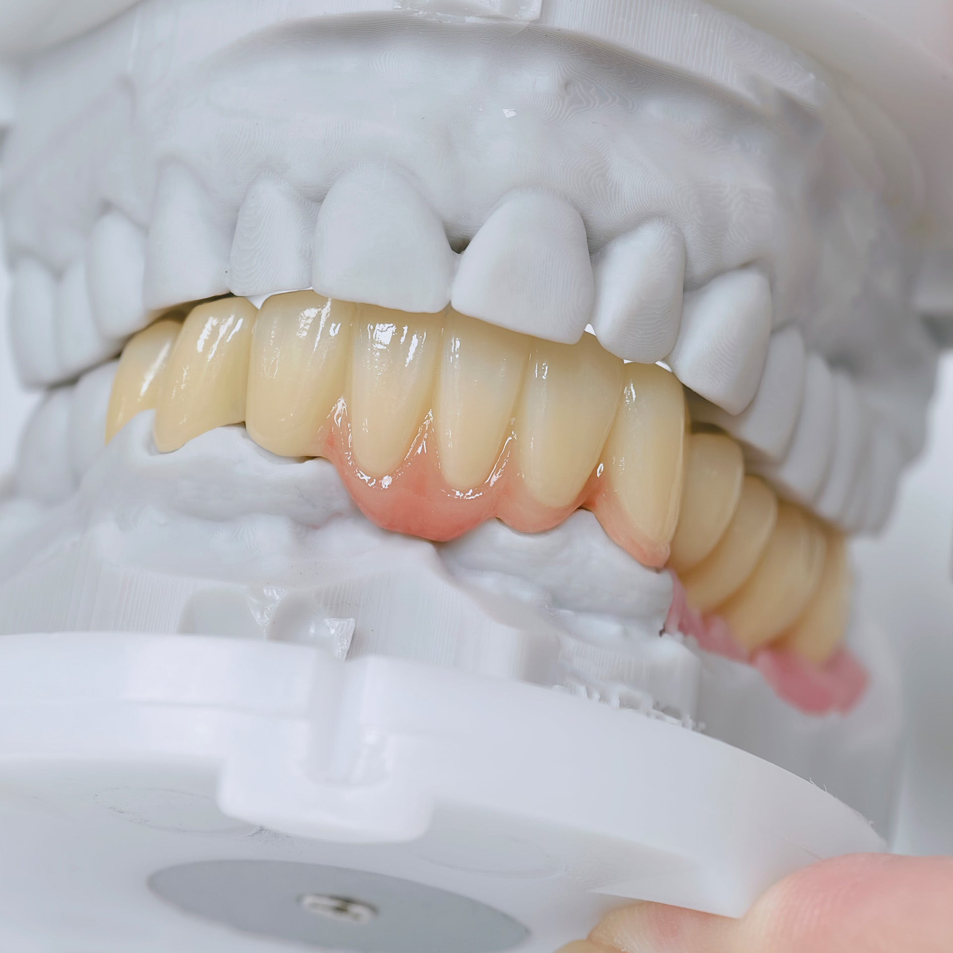 Zirconia Implant Crown And Bridges Screwmentable Dental Crown