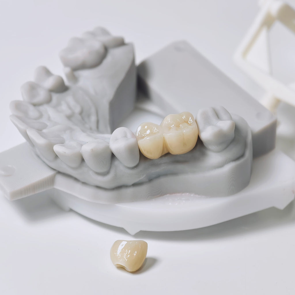 Zirconia Implant Crowns And Bridges Screwmentable Dental Crown