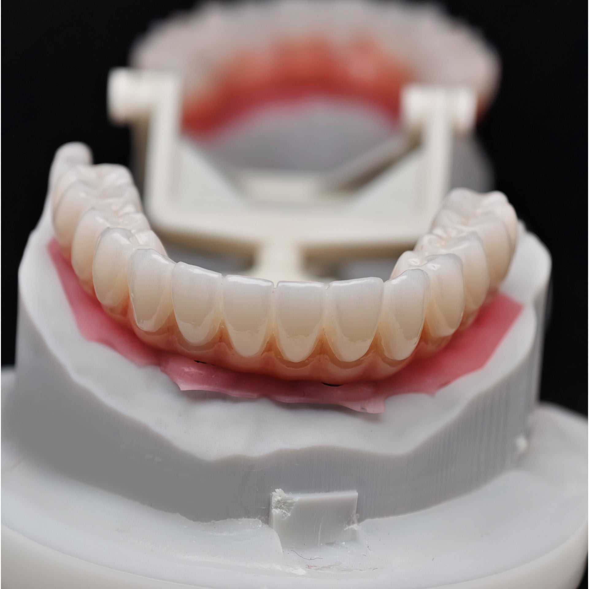 All On 4 Zirconia Bridge With Ti-Base Screw Retained Trying For Full Arch Restoration