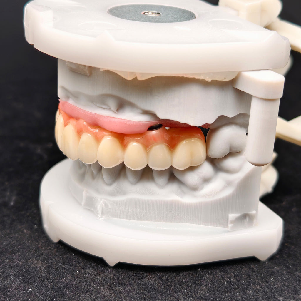 All On 4 Zirconia Bridge With Ti-Base Screw Retained Trying For Full Arch Restoration