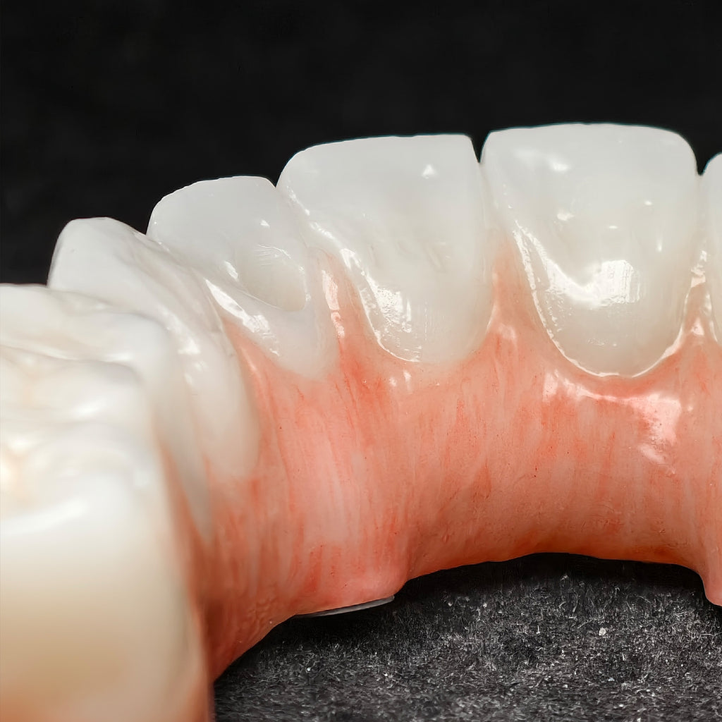 All On 4 Zirconia Bridge With Ti-Base Screw Retained Trying For Full Arch Restoration