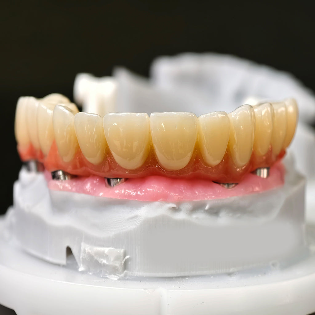 All On 5 Zirconia Bridge With Ti-Base Screw Retained Trying For Full Arch Restoration
