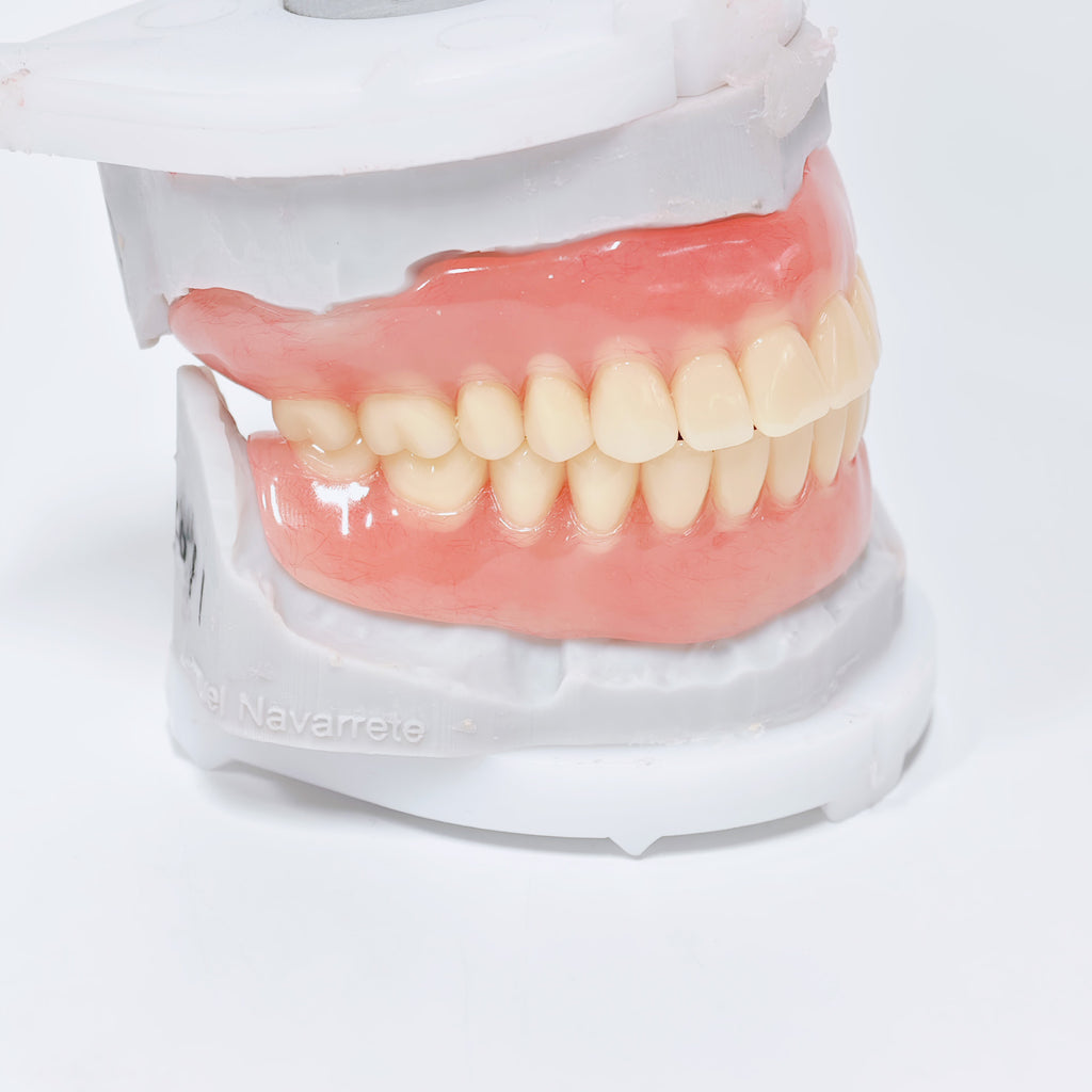 Full-Mouth Acrylic Denture