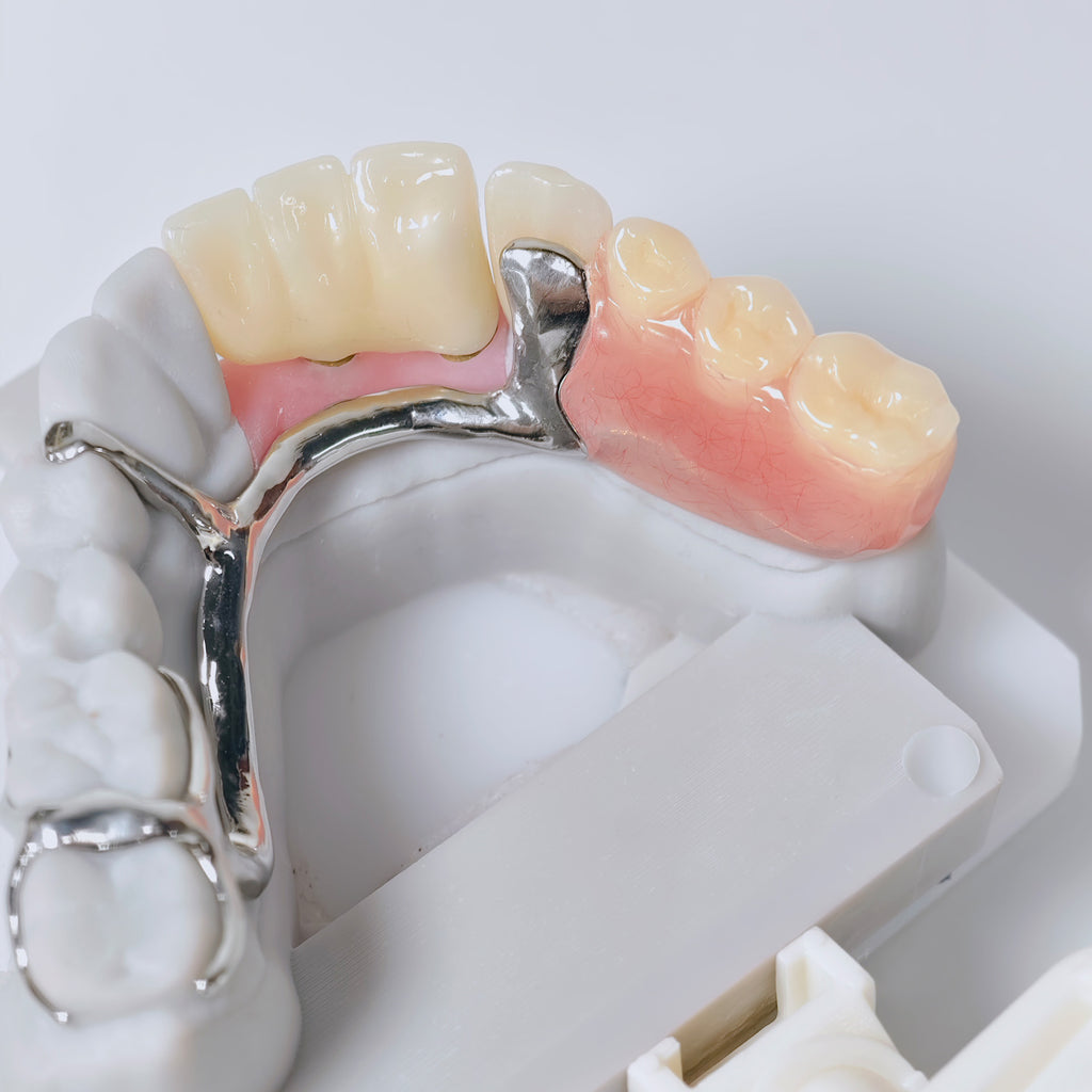 Full-Zirconia Crown And Bridge With Cement Retained And Co-Cr Frame Partial Denture