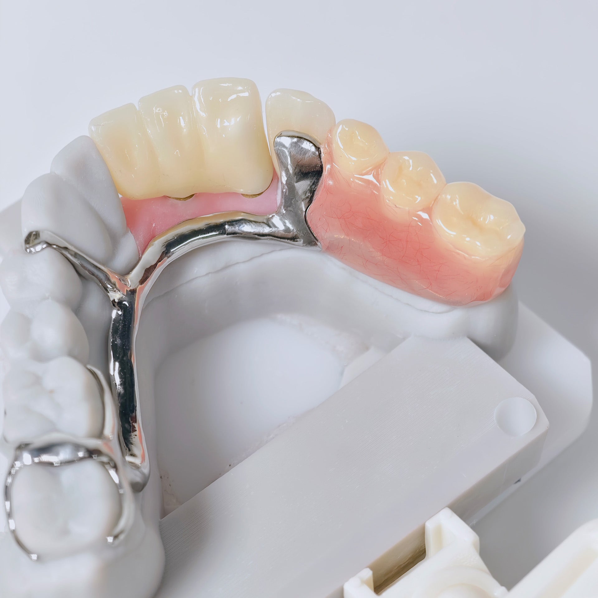 Full-Zirconia Crown And Bridge With Cement Retained And Co-Cr Frame Partial Denture
