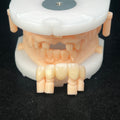 Multilayer Zirconia Bridges Aesthetic And Natural Restoration