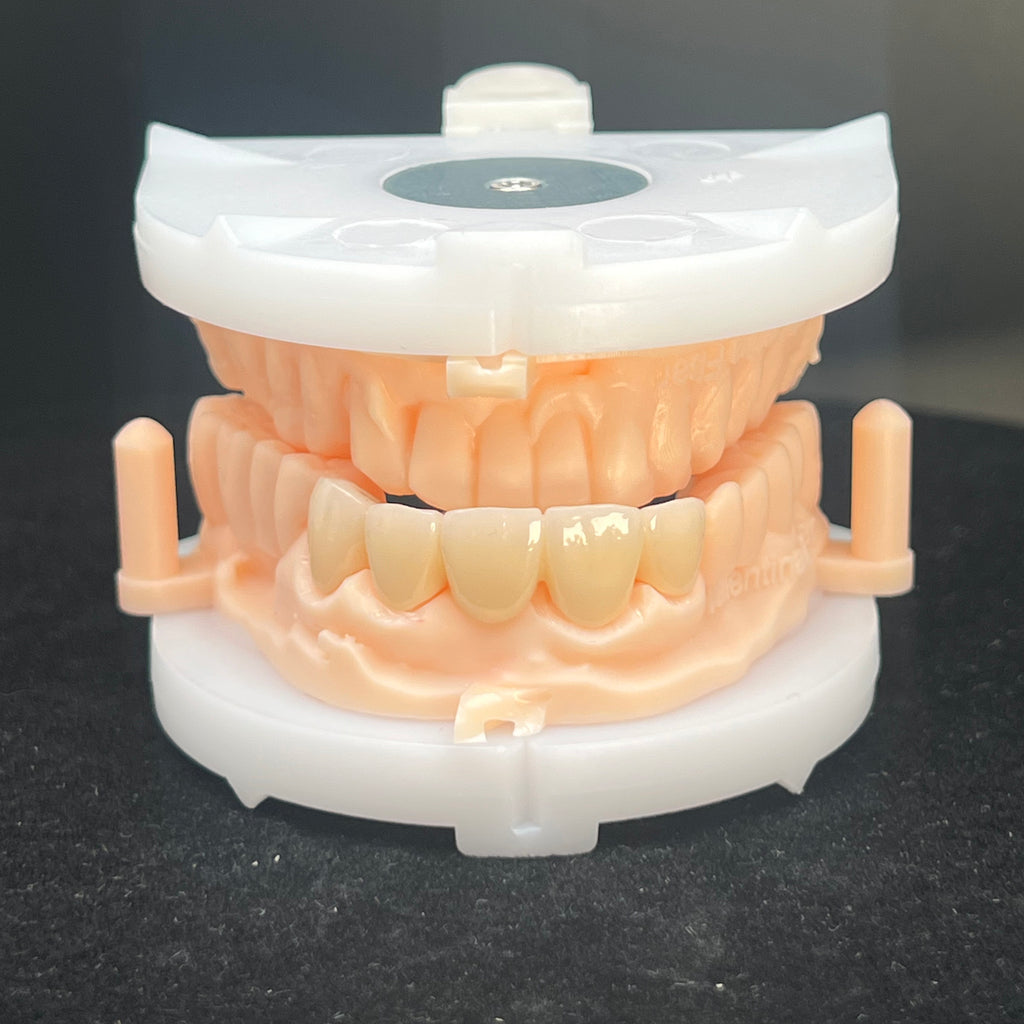 Multilayer Zirconia Bridges Aesthetic And Natural Restoration