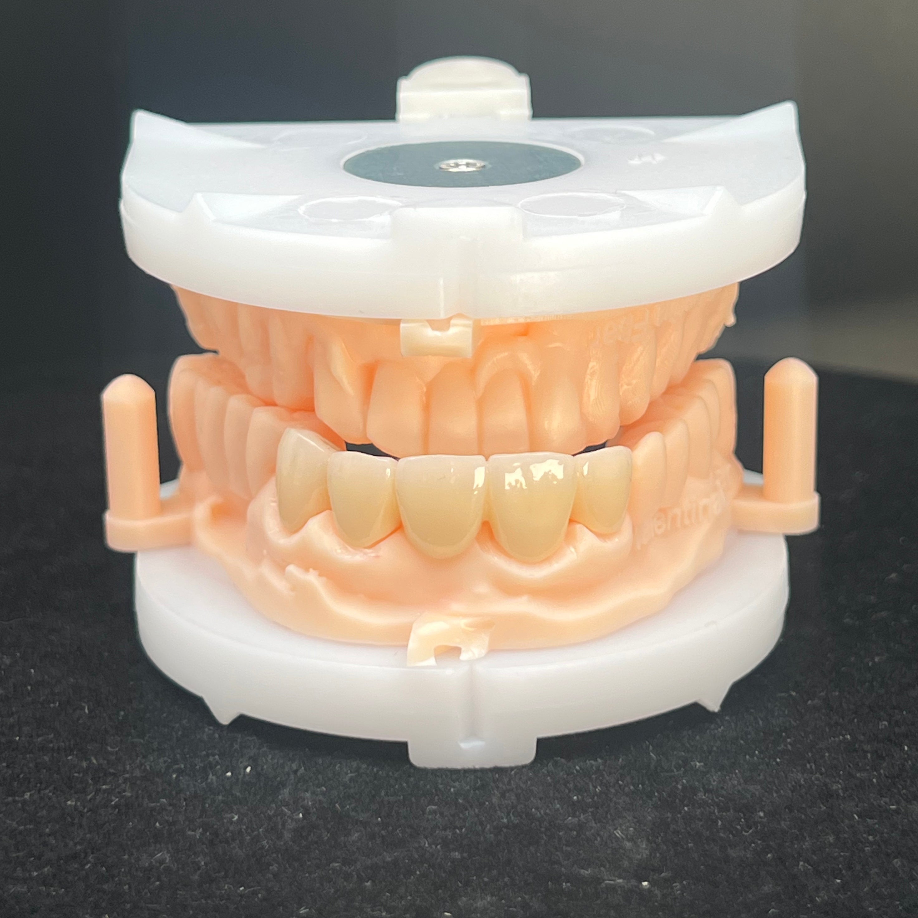 Multilayer Zirconia Bridges Aesthetic And Natural Restoration