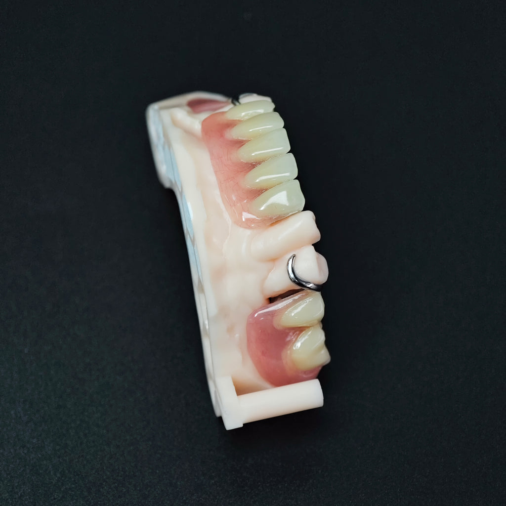 Cobalt Chrome Framework Denture Metal Framework With Acrylic Denture