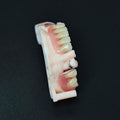 Cobalt Chrome Framework Denture Metal Framework With Acrylic Denture