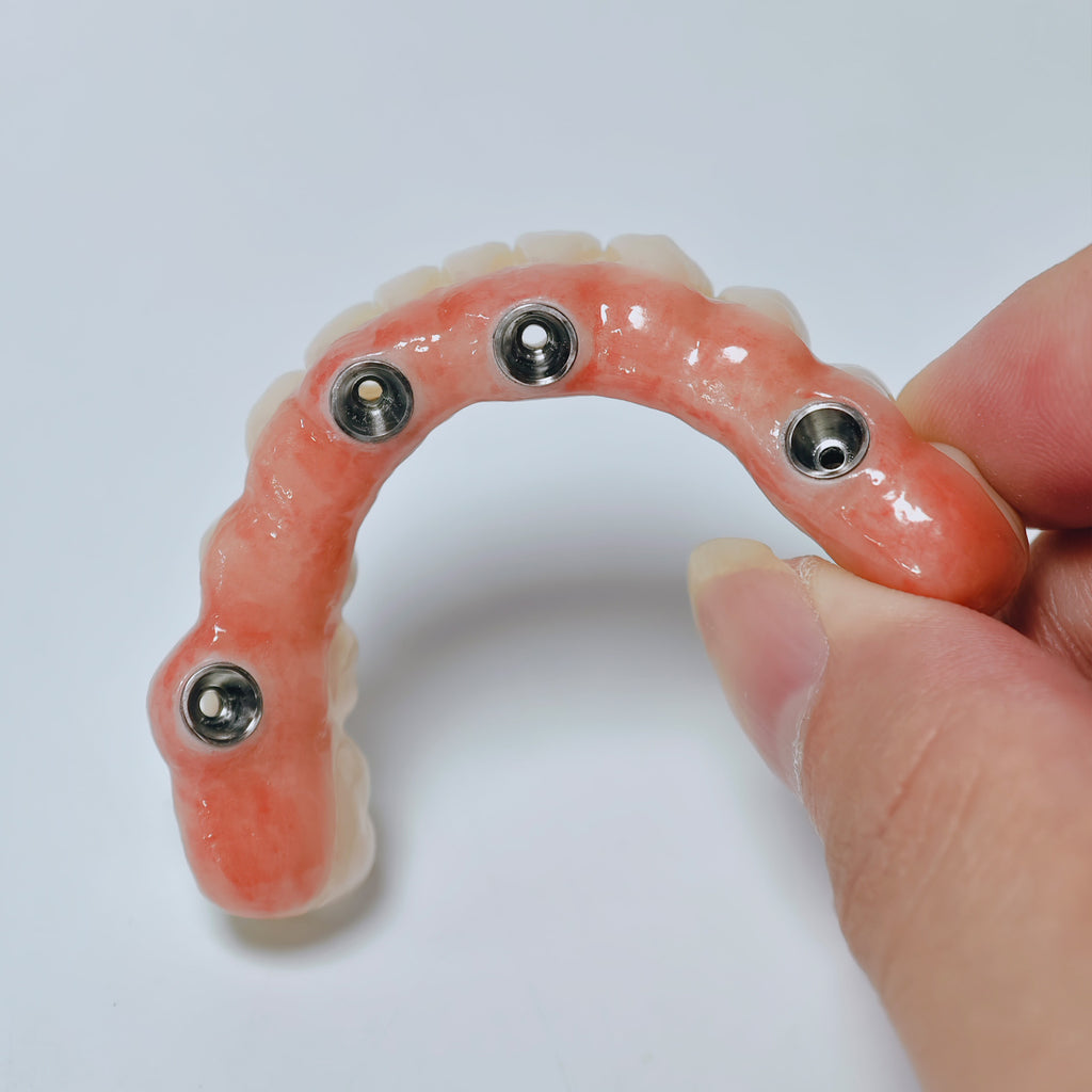 All On 4 Zirconia Bridge With Ti-Base Screw Retained