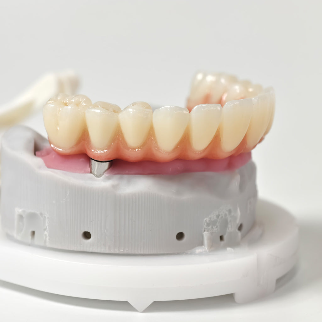 All On 5 Zirconia Bridge With Ti-Base Screw Retained