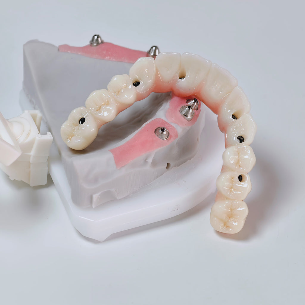 All On 6 Zirconia Bridge With Ti-Base Screw Retained