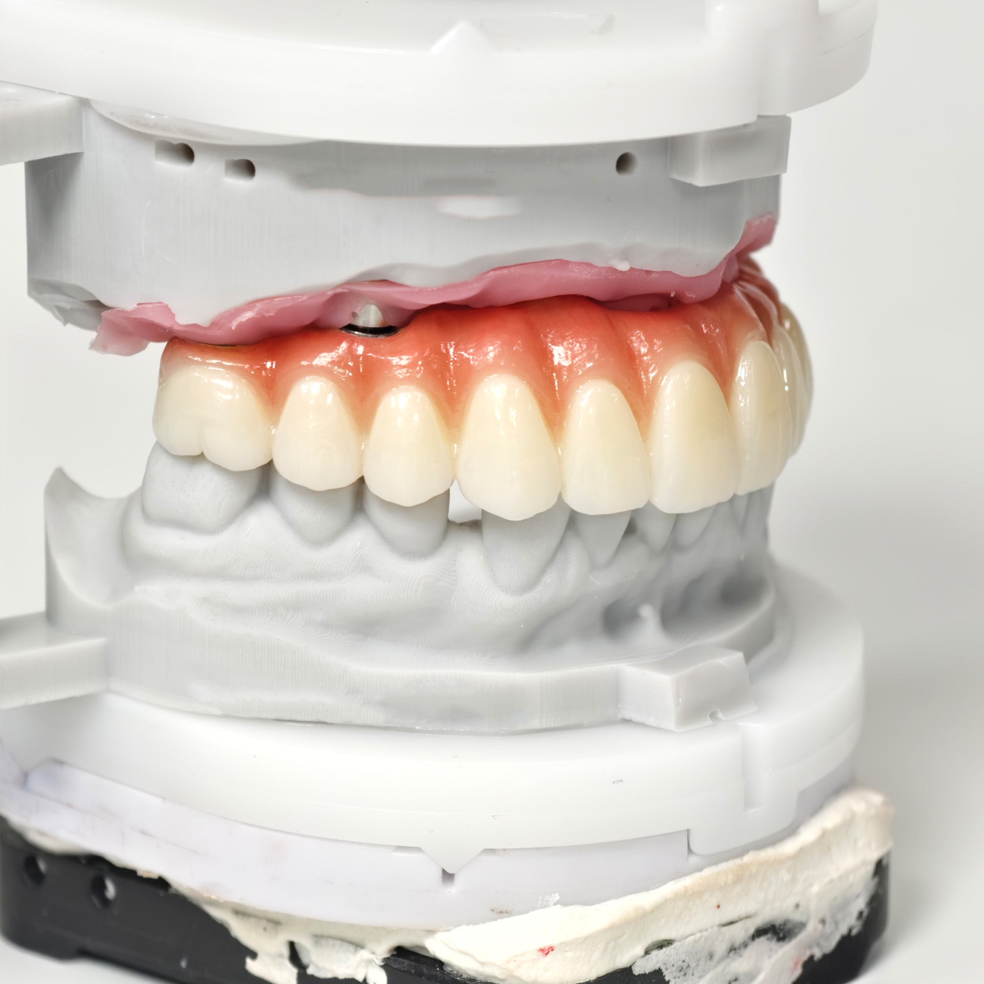 All On 6 Zirconia Bridge With Ti-Base Screw Retained