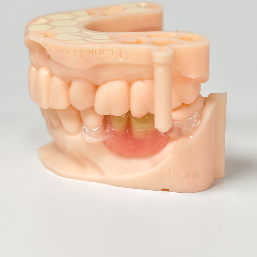 Clear Framework With Acrylic Denture Aesthetic Denture