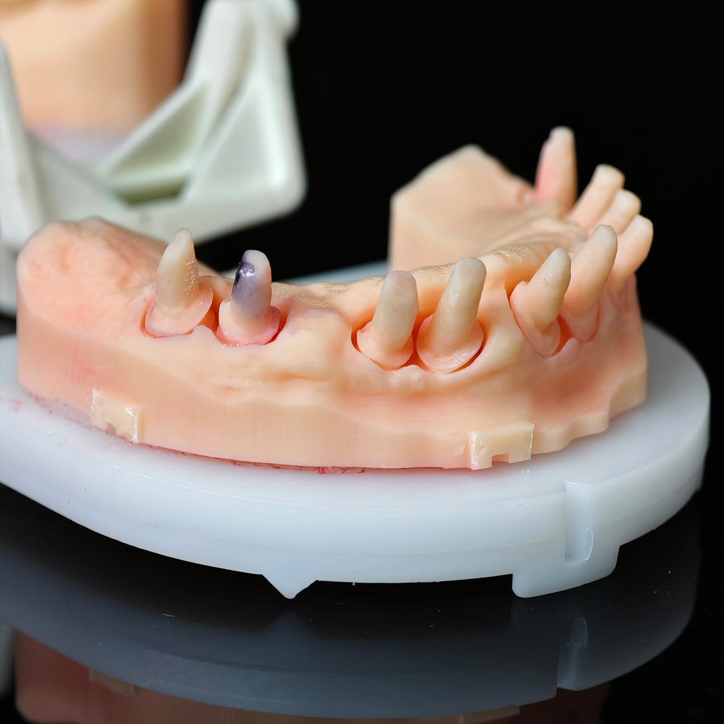 Co - Cr PFM Dental Bridge