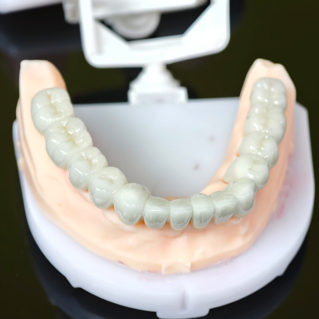 Co - Cr PFM Dental Bridge