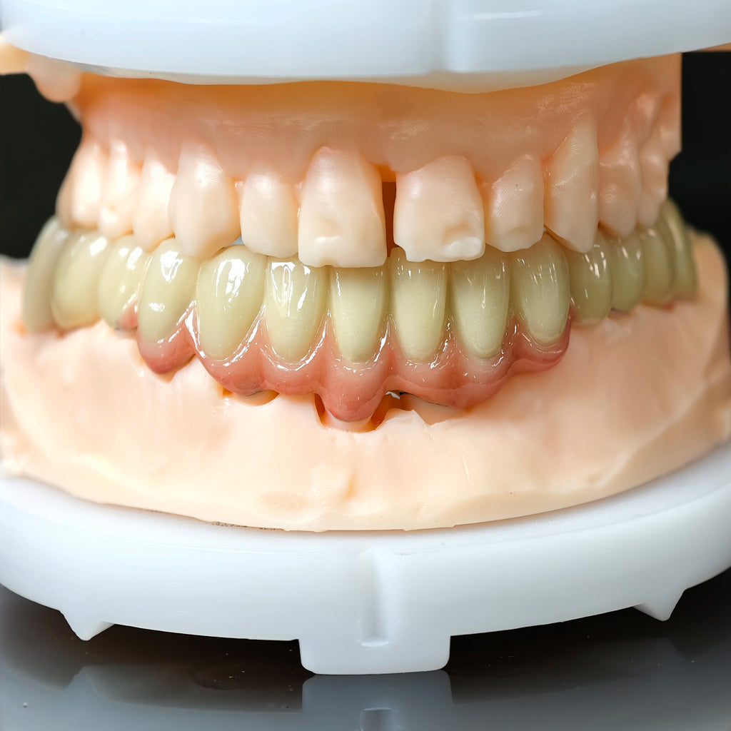 Co - Cr PFM Dental Bridge