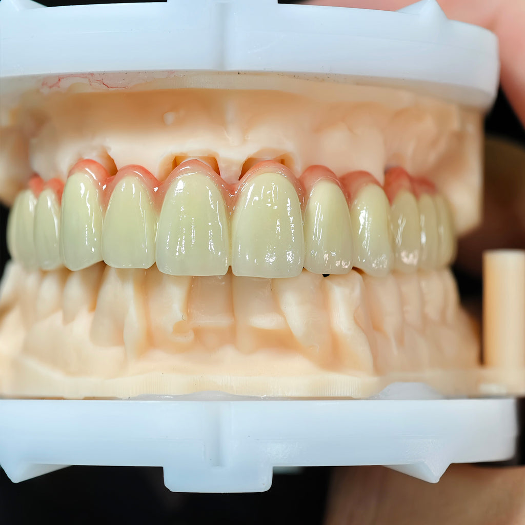 Co - Cr PFM Dental Bridge