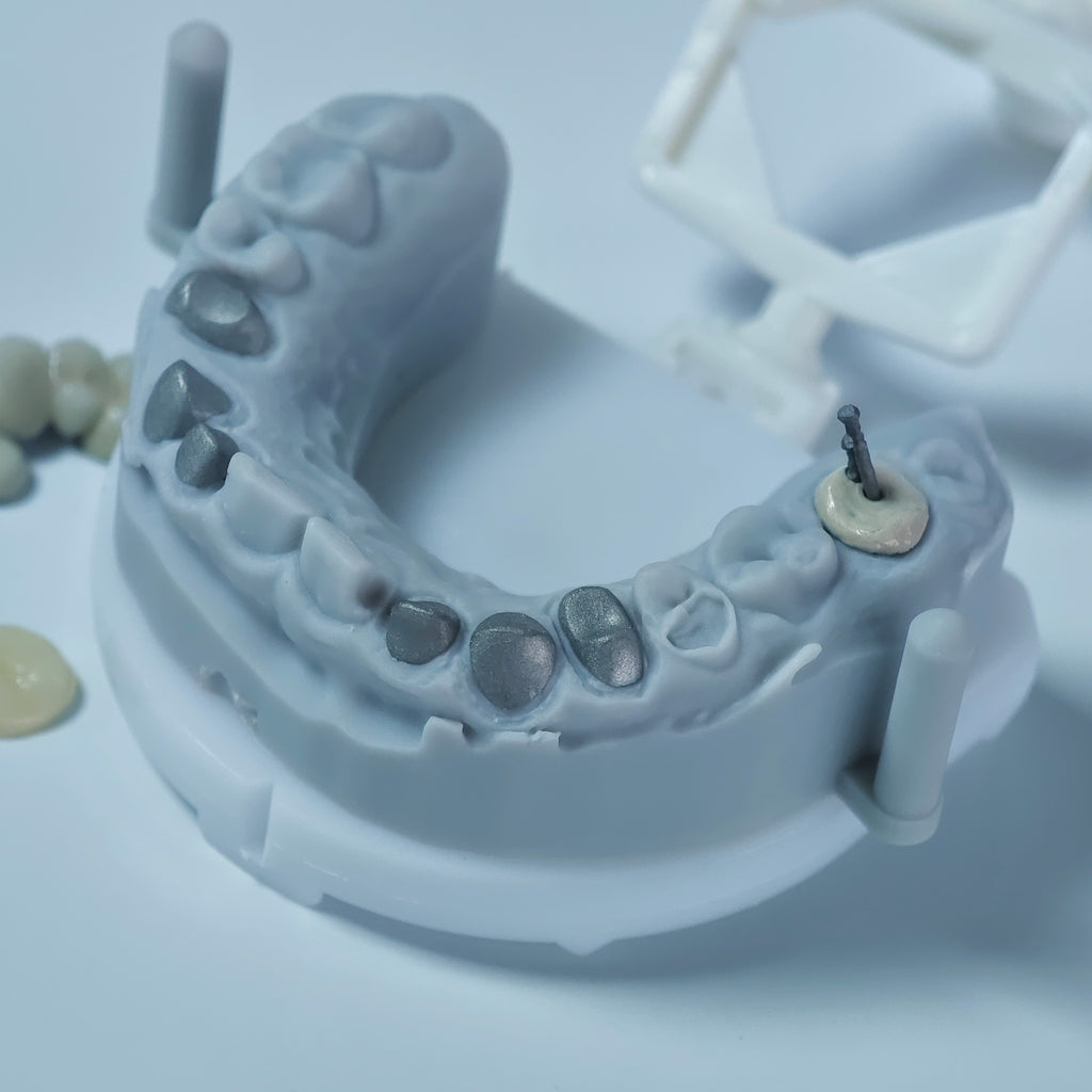 Co - Cr PFM Dental Crowns With Metal Post-And-Core