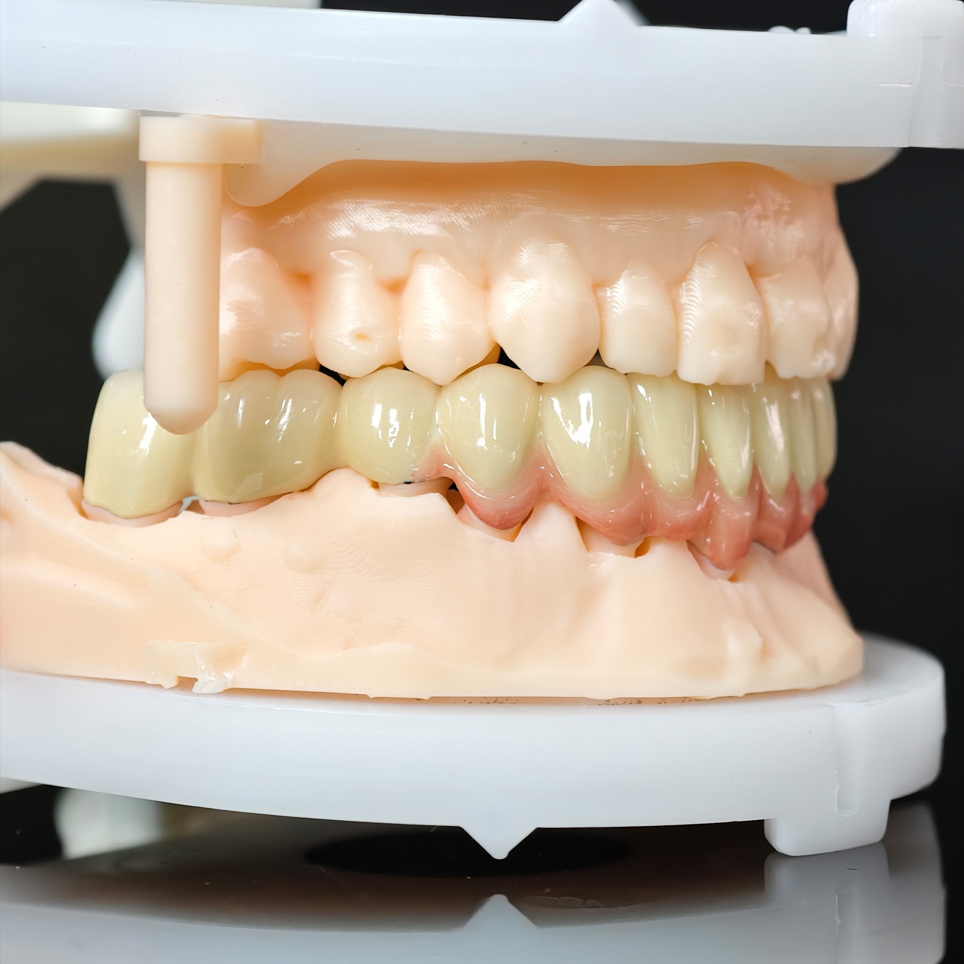 Co - Cr PFM Dental Bridge