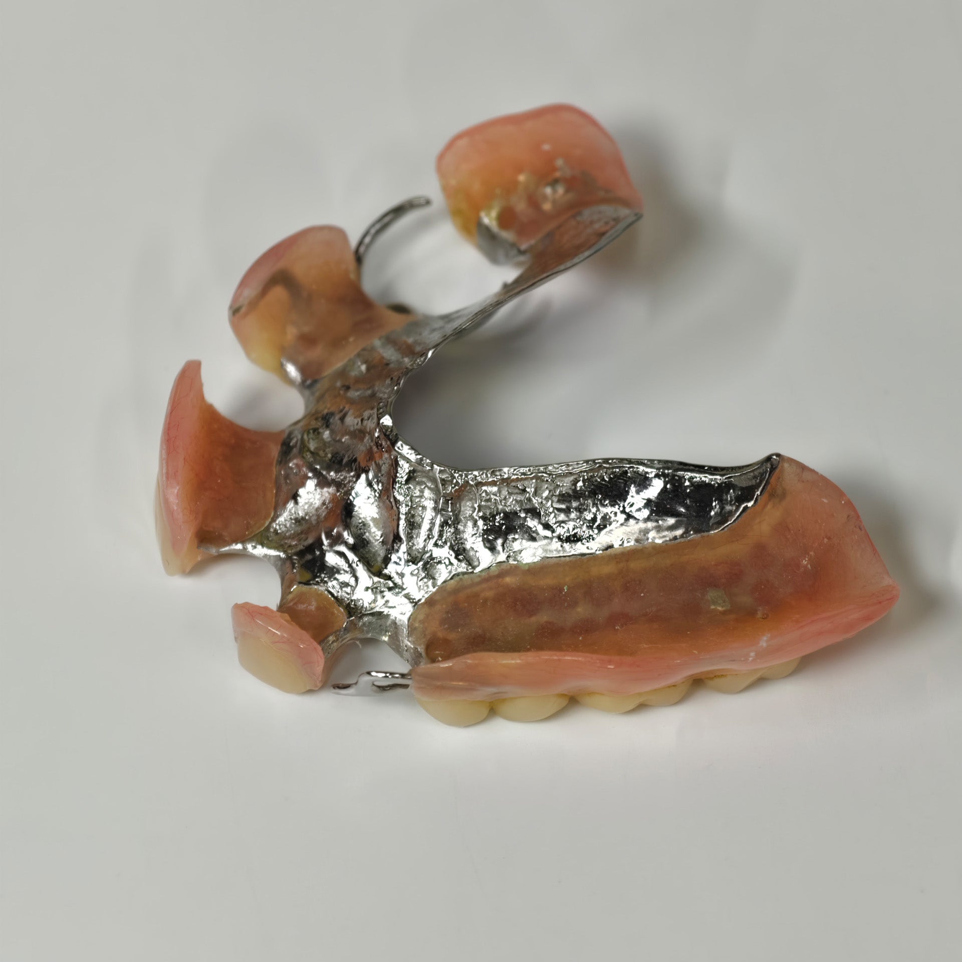 Cobalt Chrome Framework Denture Metal Framework With Acrylic Denture
