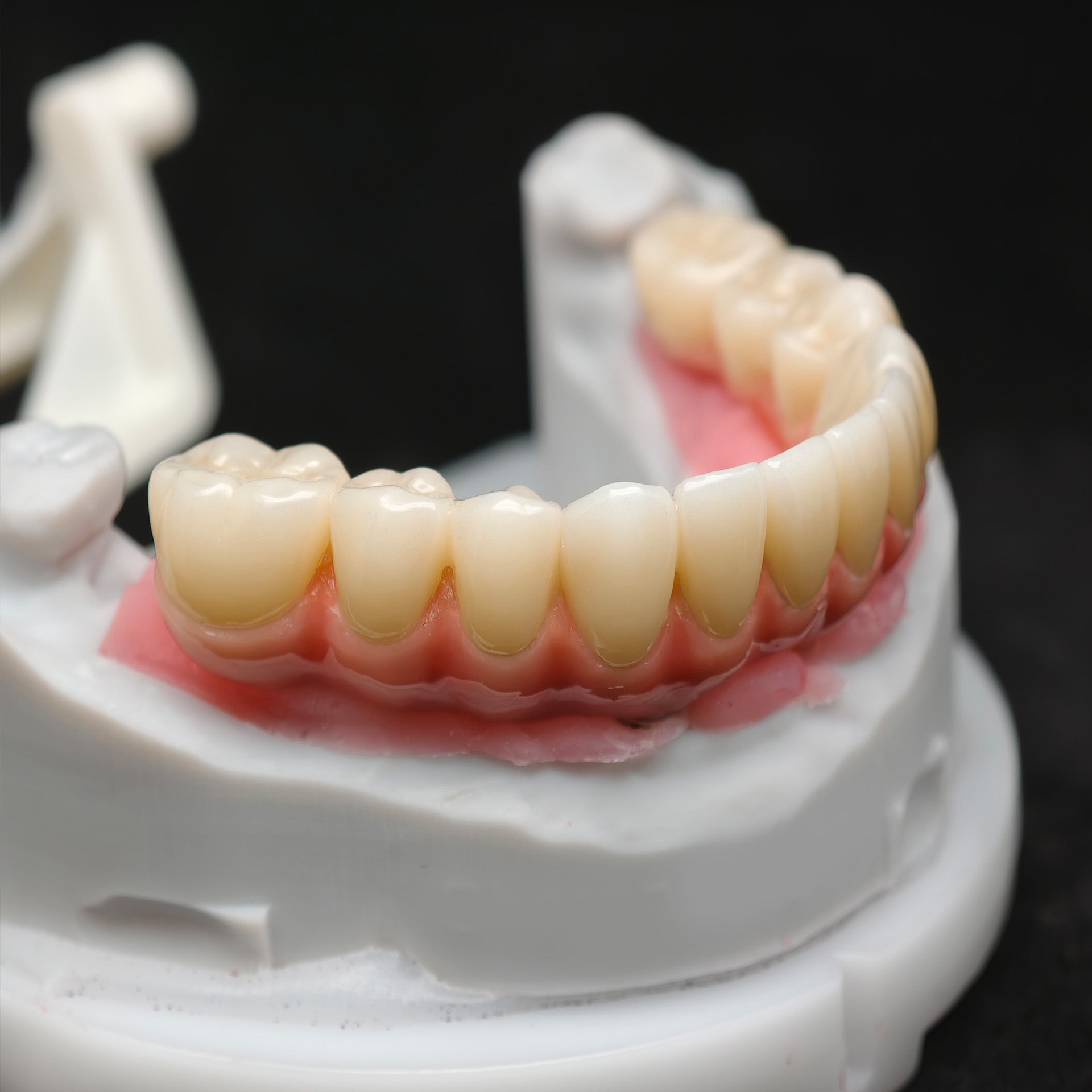 Enhanced Zirconia Crown Malo Bridge