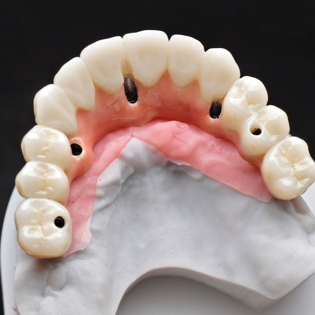 Enhanced Zirconia Crown Malo Bridge