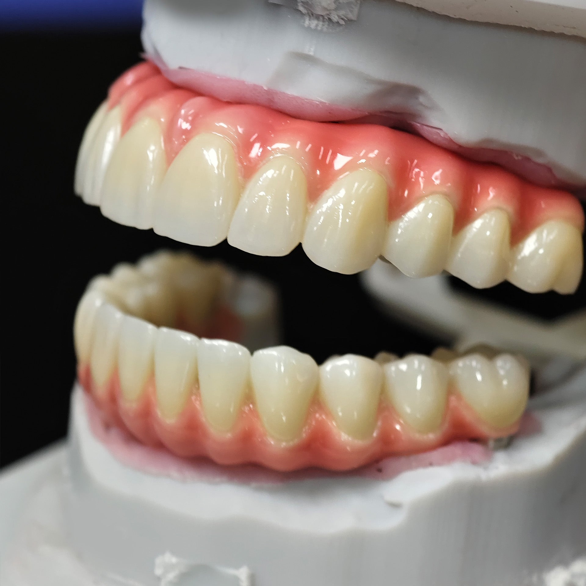 Enhanced Zirconia Crown Malo Bridge