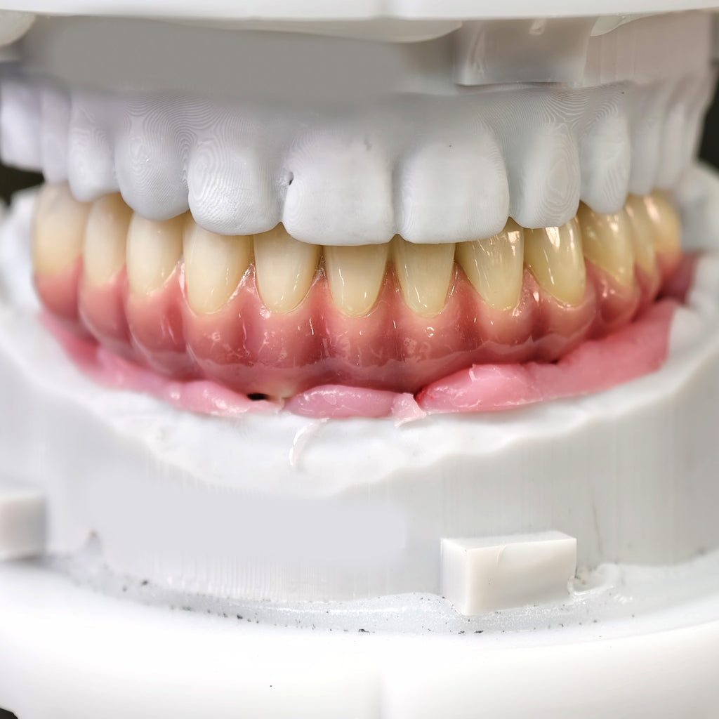 Enhanced Zirconia Crown Malo Bridge